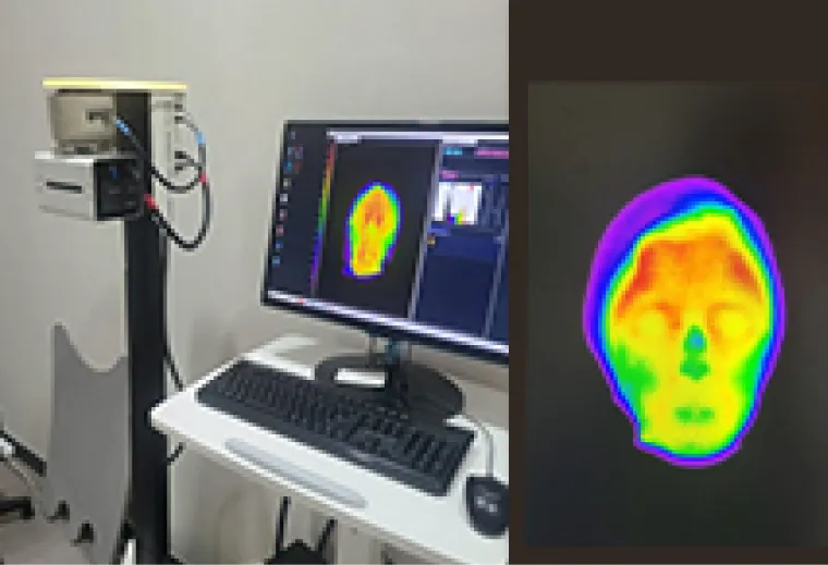안면체열진단 검사 이미지